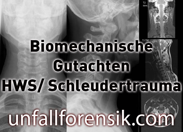 biomechanische Gutachten HWS Schleudertrauma